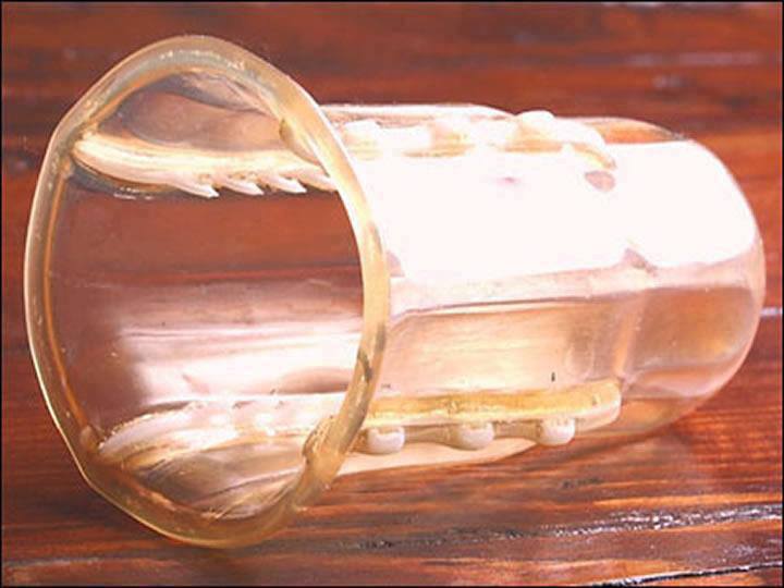 A Female Condom that puts teeth in the fight against rape